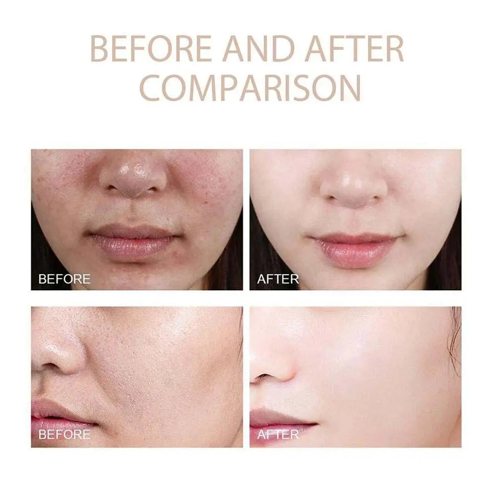 Dr. Melaxin Rice Exfoliating Serum - Hydrating Facial Moisturizer for Blackhead Removal and Pore Minimization in Korean Skin Care